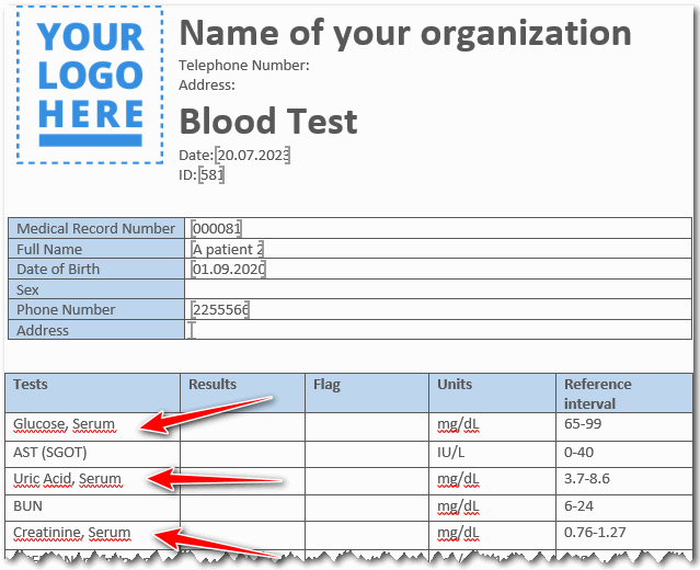 Manual filling without templates