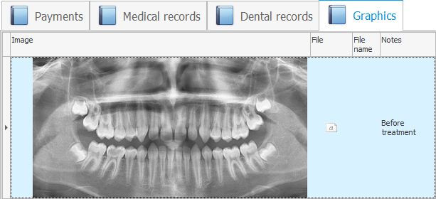 X-rays