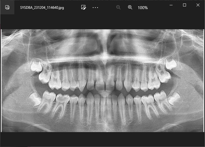 ເບິ່ງຮູບພາບ X-ray ໃນໂຄງການພາຍນອກ