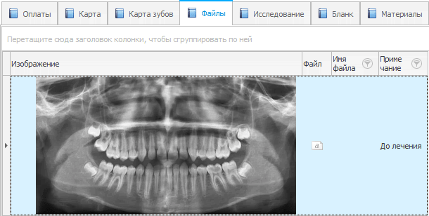 Рентген-снимки