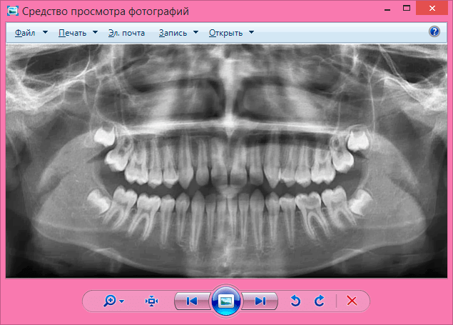 Просмотр рентгеновского снимка во внешней программе